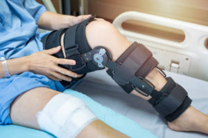 what not to do after acl surgery