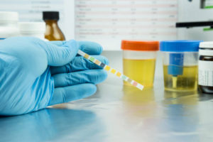 what is mtd on a drug test