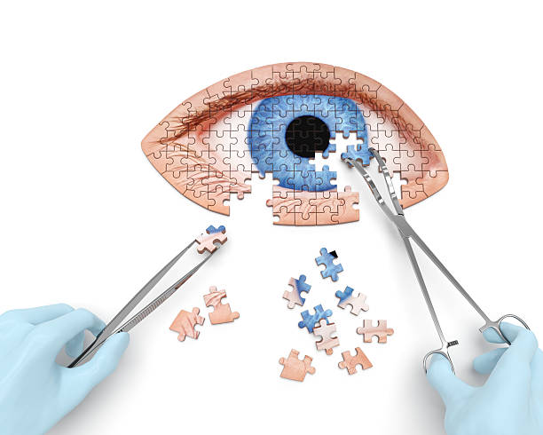 how long can cataract surgery be postponed