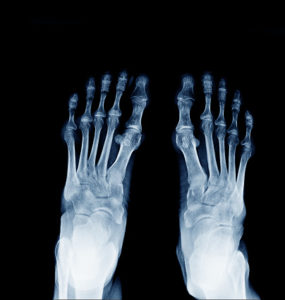 what doctor to see for numbness in toes